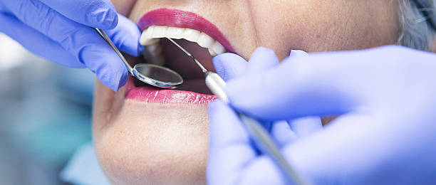 Best Emergency Dentist for Knocked-Out Tooth in West Belmar, NJ