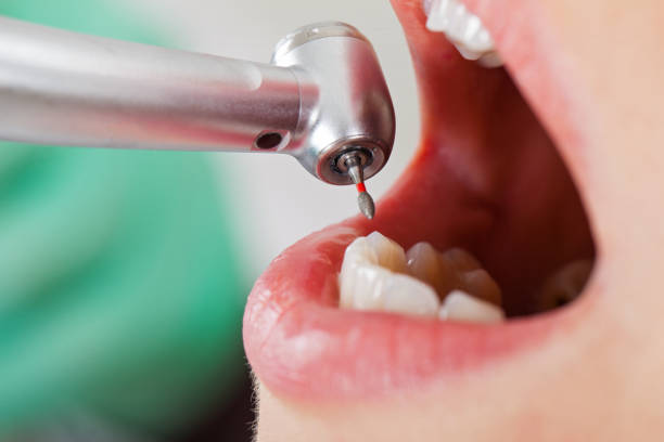 Best Pediatric Emergency Dentist in West Belmar, NJ
